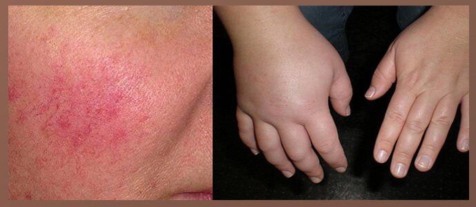 Pilienu blakusparādības